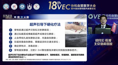 聚桂醇微创硬化治疗技术学术推广会六会同开，软件助力数字化诊疗